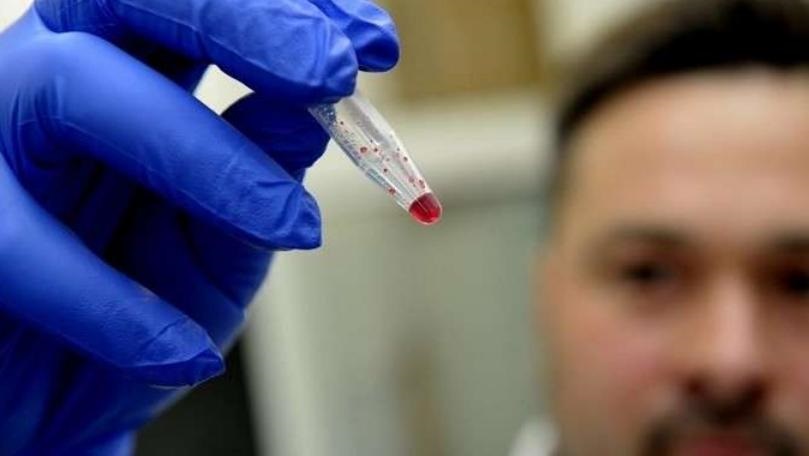 اكتشاف يُضعف الخلايا السرطانية ويخفّف عناء المرضى