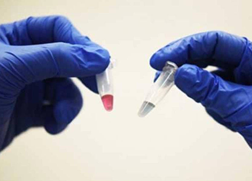 عقار ثوري للسرطان يضرب "ساعته البيولوجية"