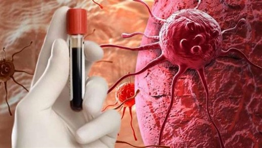 اكتشاف سبب ظهور سرطان الدم