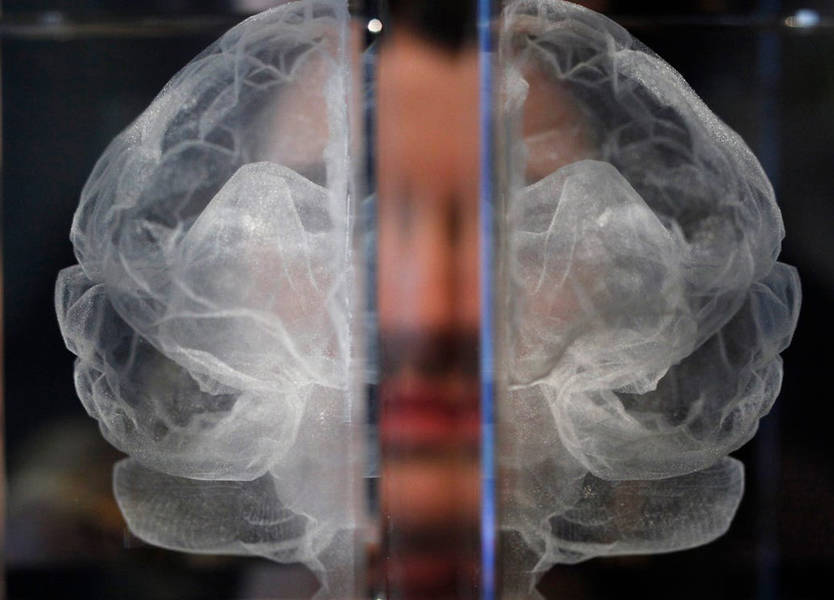 علماء يحققون اكتشافاً مهماً في علاج الألزهايمر