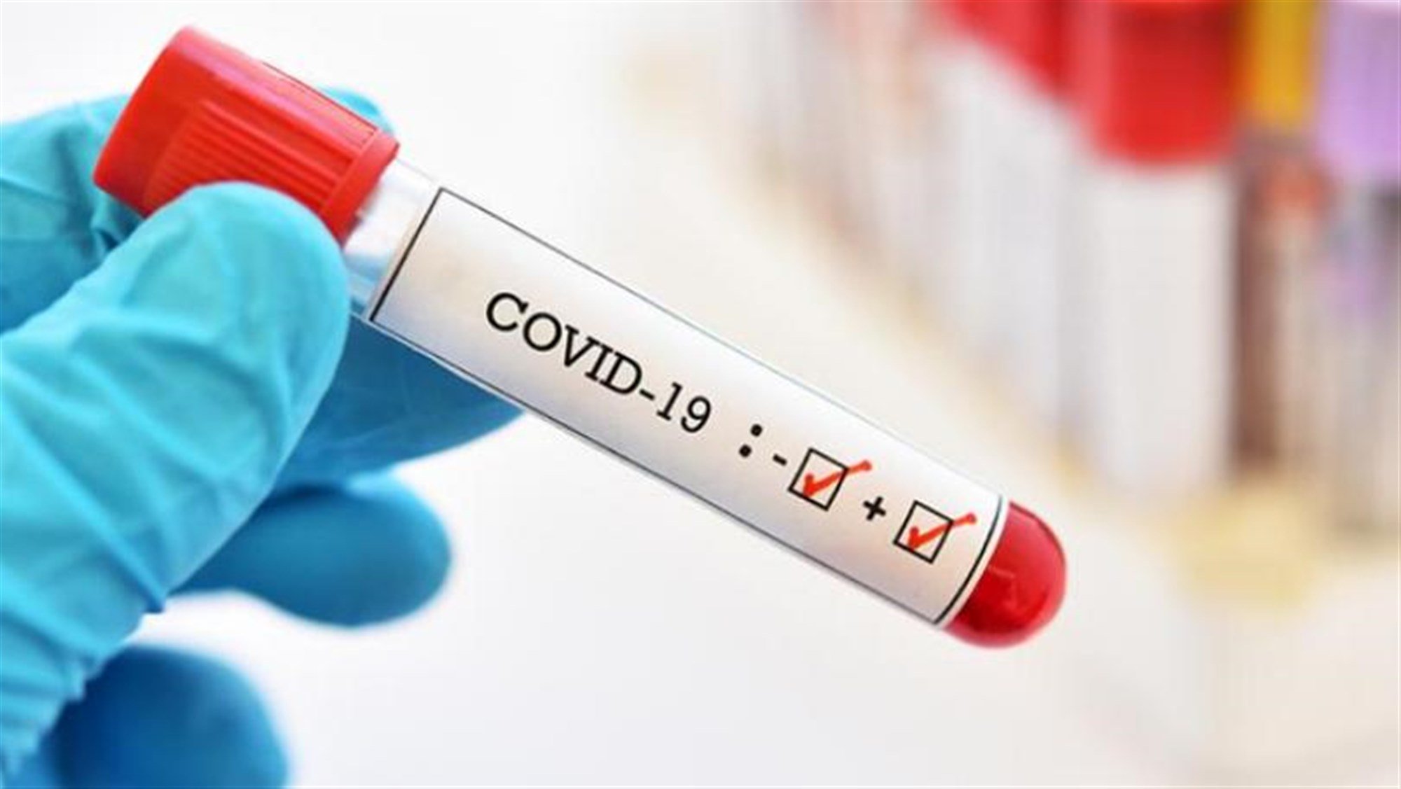 ماذا يعني إسم "كوفيد - 19"؟