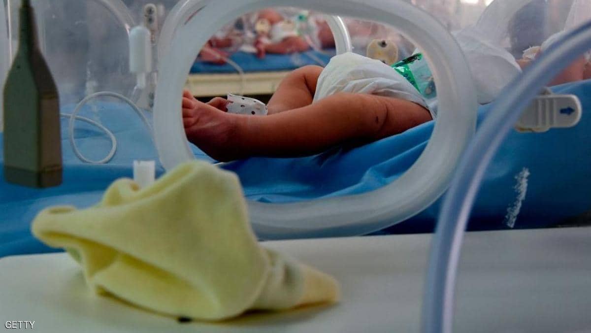 أول إصابة بـ"كاواساكي" النادر في الجزائر