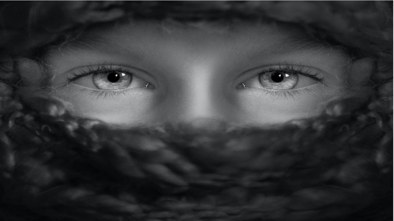 ظهور علامة غريبة في العينين ينوه بنقص فيتامين أساسي!