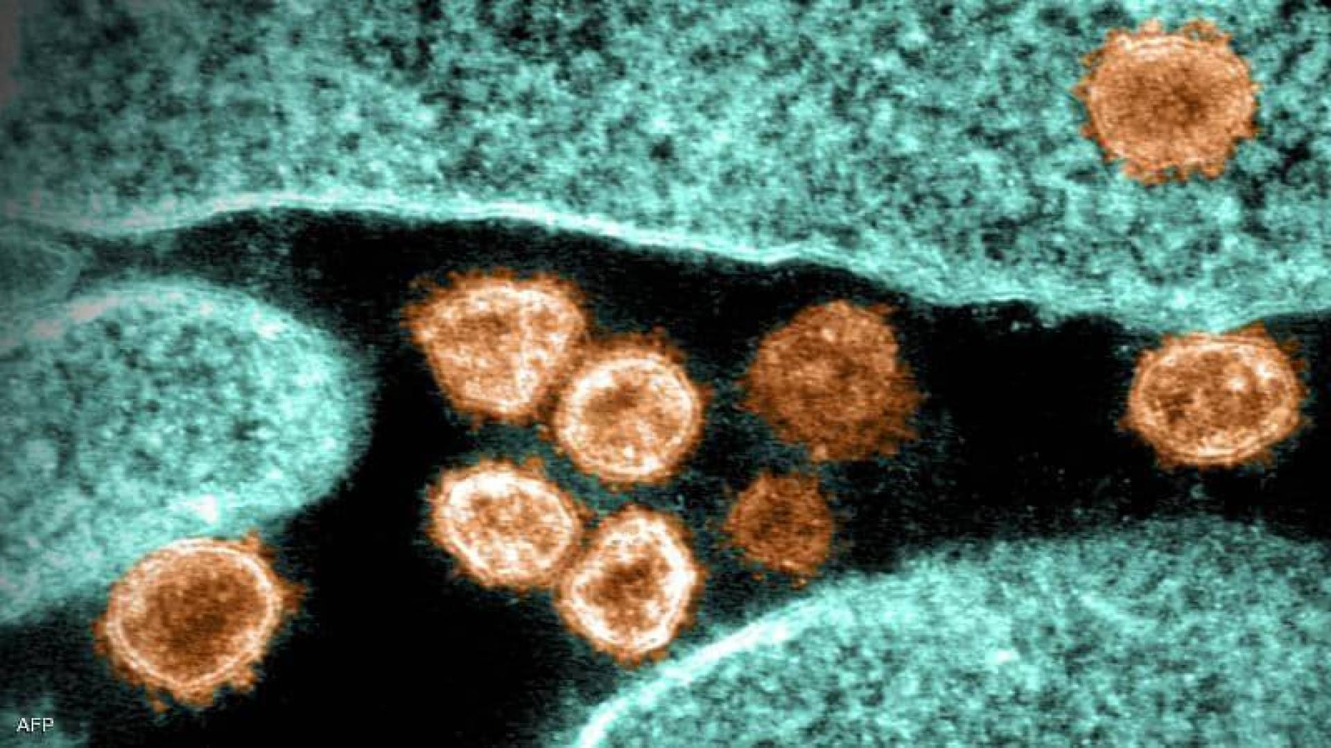 تحذير من "متحور كورونا" يقتل ثلث المصابين به!