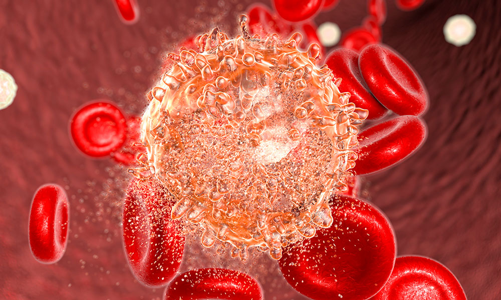 علاج جديد يدمر الخلايا السرطانية