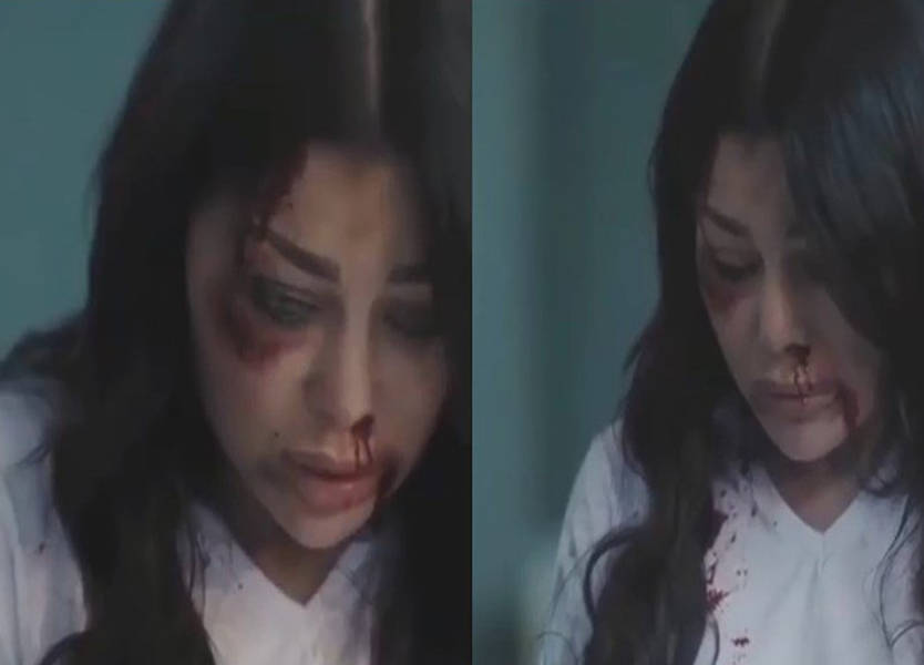 هيفا وهبي مضرّجة بالدماء وآثار الضرب على وجهها... ما القصة؟